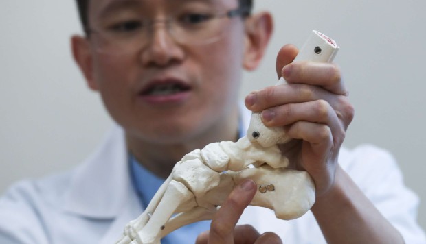 Ankle bone replicated with 3D printing technology in medical first for Hong Kong - South China Morning Post