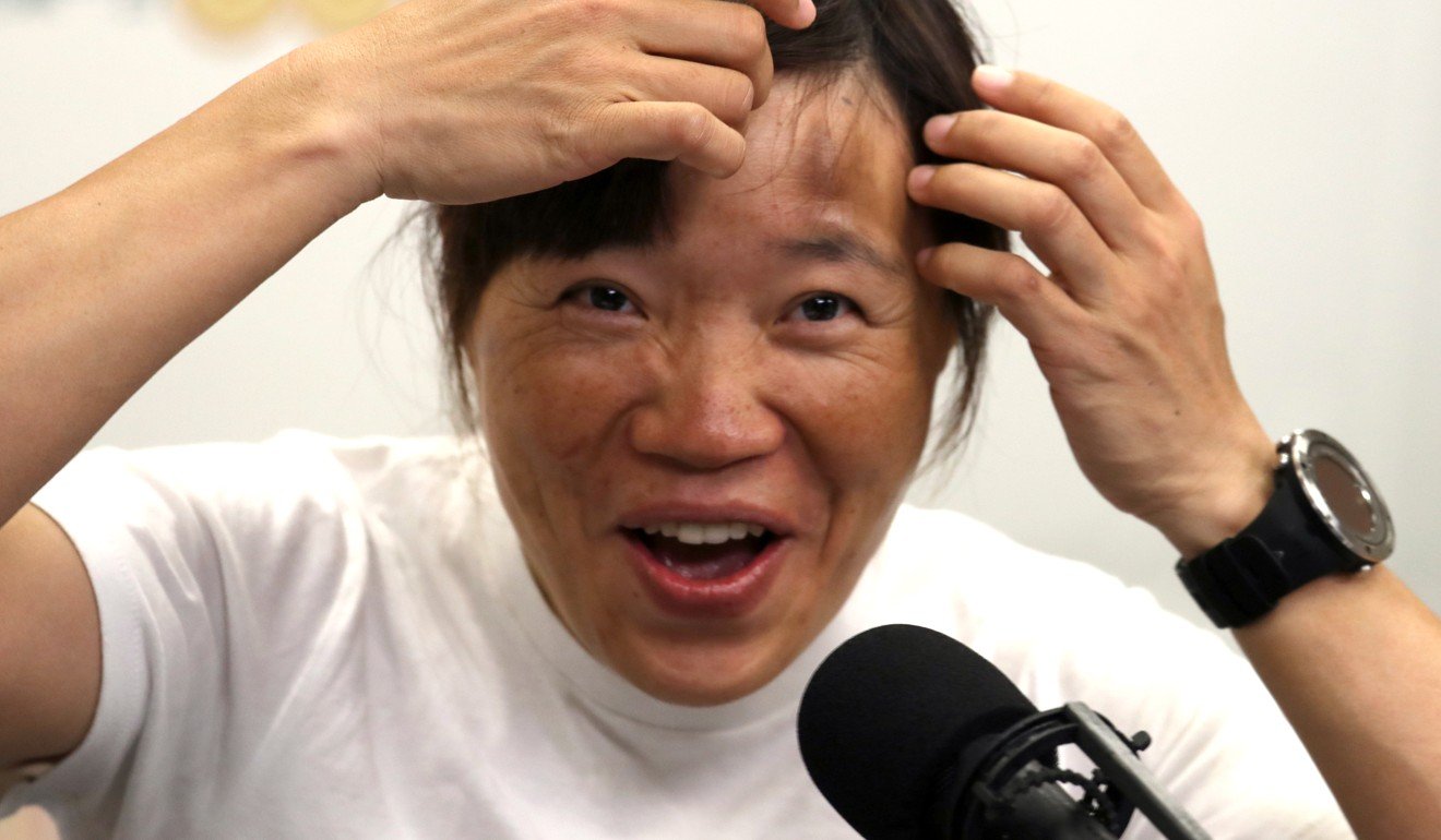 Tsang shows the sunburn on her forehead, from the expedition. Photo: Nora Tam