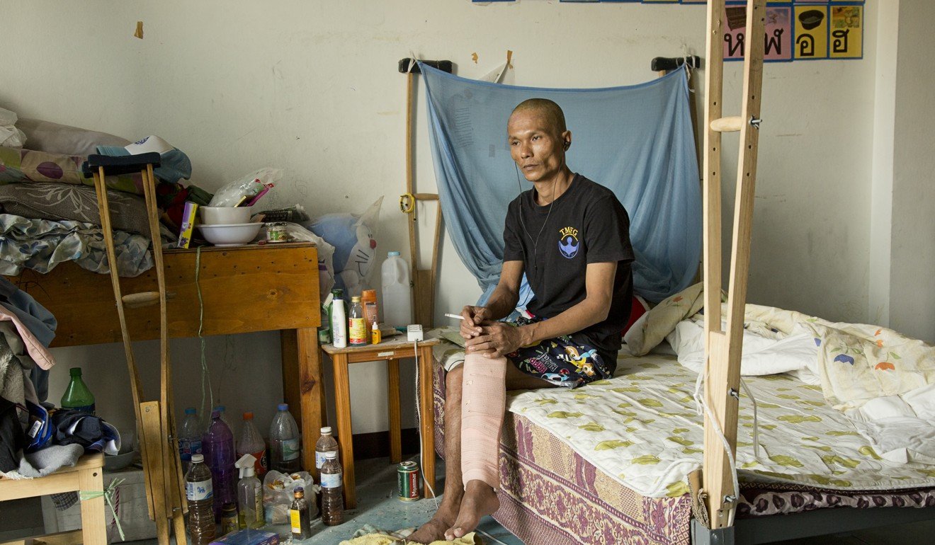 Ule Miomin migrated from Myanmar to Thailand to work in the fishing industry but was dismissed when his leg was injured in an accident. Photo: Antolin Avezuela