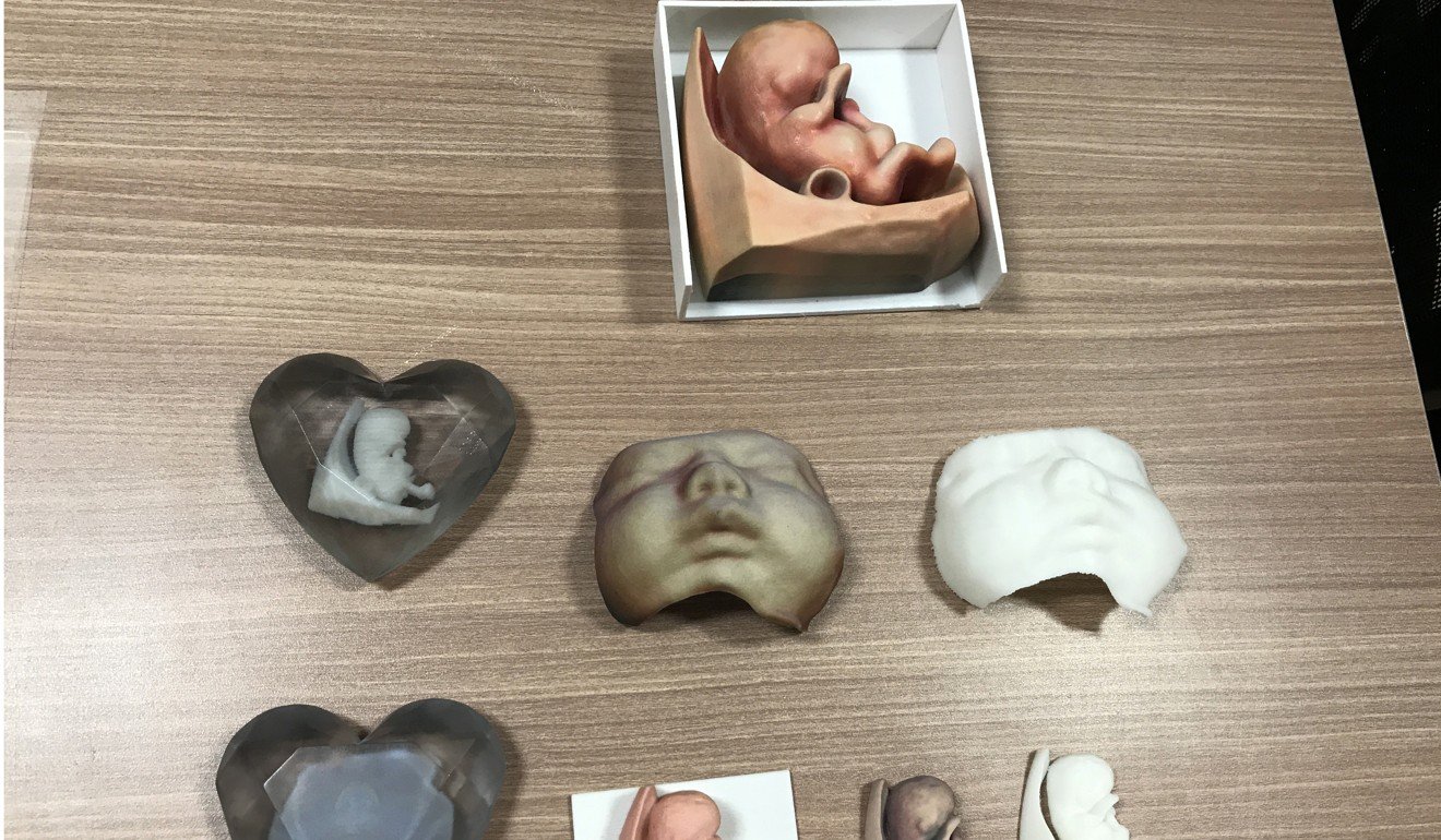 Parents can choose between plain and coloured 3D models of their unborn child. Photo: Elizabeth Cheung