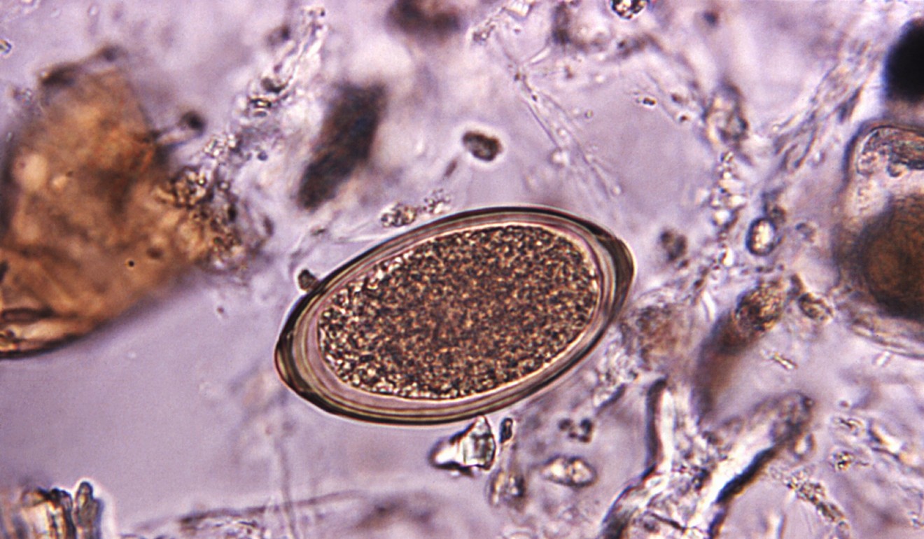 Photomicrograph of a parasitic whipworm egg. Photo: Alamy