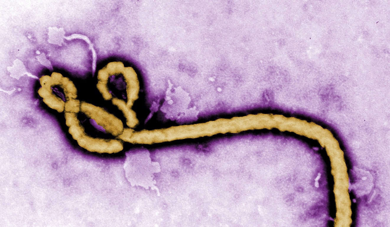 In this undated electron micrograph file image made available by the CDC shows an Ebola virus virion. H Photo: AP