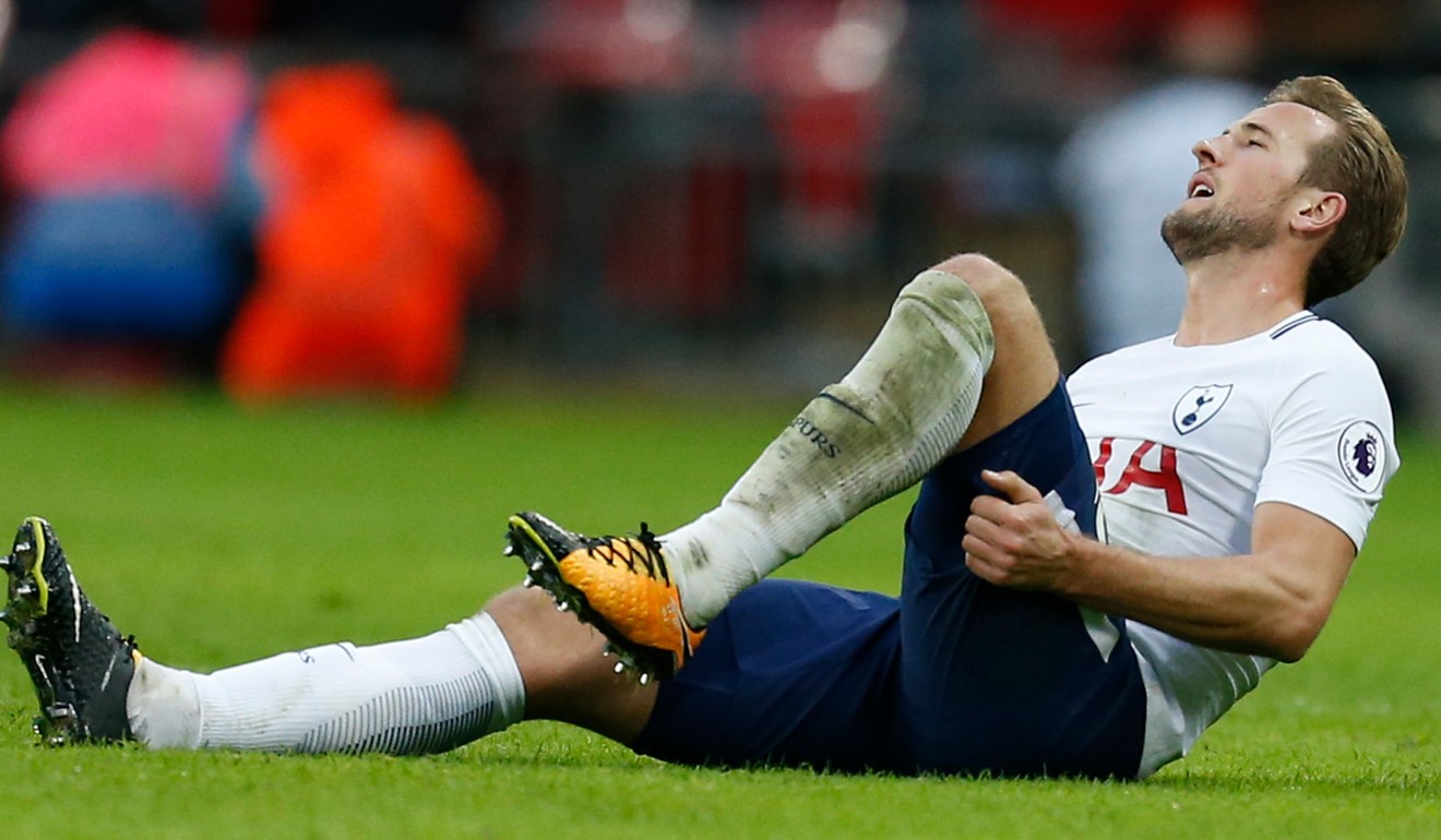 Harry Kane picked up an injury against Liverpool at Wembley last weekend. Photo: AFP