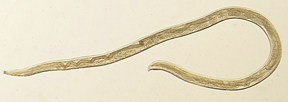 This undated photo provided by the Centres for Disease Control and Prevention (CDC) shows Thelazia gulosa, a type of eye worm seen in cattle in the northern United States and southern Canada, but never before in humans. Photo: AP