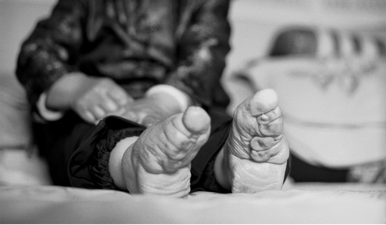 Foot Binding Photos Of Chinese Women The Tiny Shoes They Wore And X