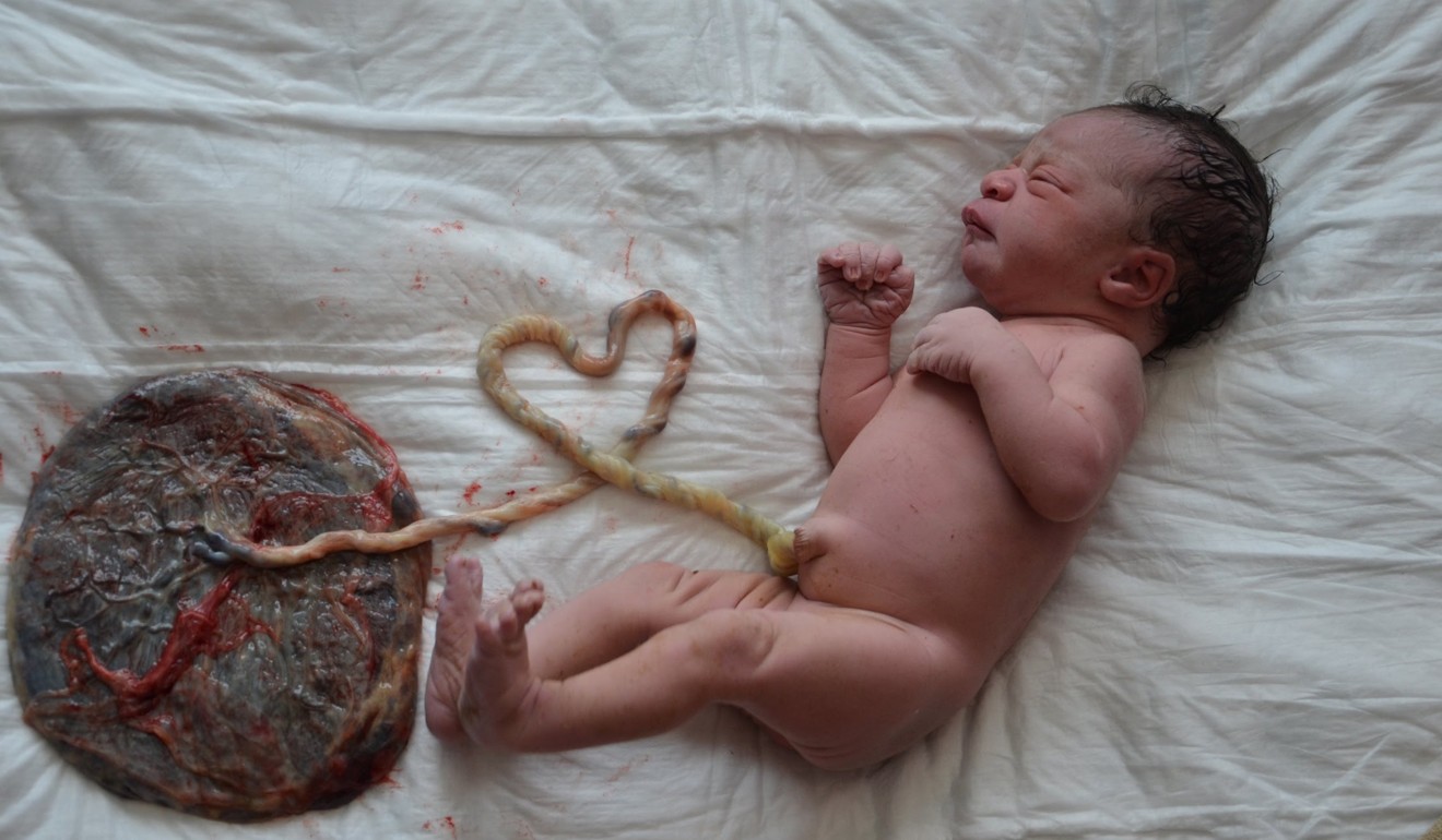 A lotus birth is when the umbilical cord isn’t cut and instead allowed to drop off naturally.