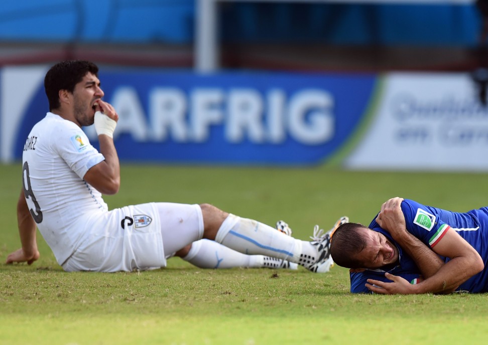 Luis Suarez grabs his teeth after biting Italy defender Giorgio Chiellini at the 2014 World Cup – an incident that went unpunished by the referee but later earned Suarez a four-month ban. Photo: AFP