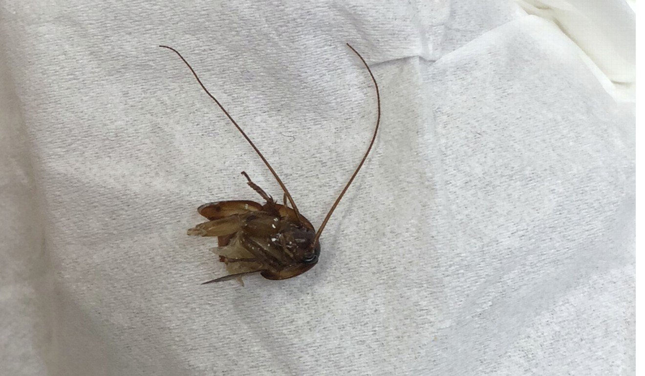 A photo made available by Katie Holley shows the head of a cockroach pulled from her ear. Photo: AP 