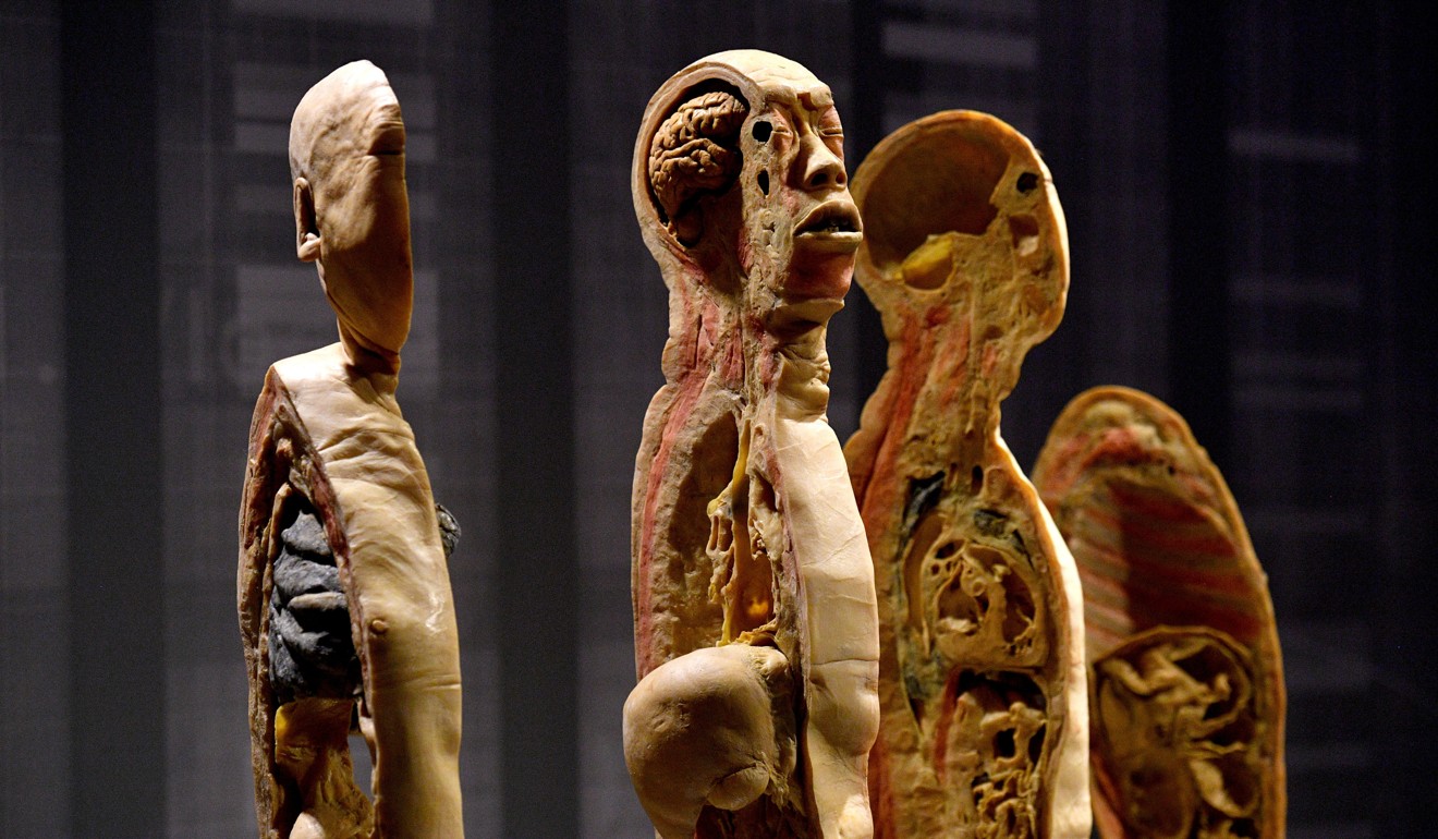 Human remains are seen at the “Real Bodies” exhibition in Sydney, Australia, in April. The travelling anatomical show is currently in Birmingham in Britain. Photo: EPA