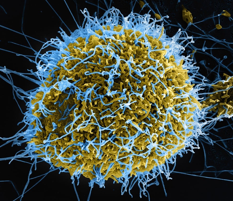 seven-of-the-most-deadly-viruses-from-ebola-to-rabies-hidden-killers