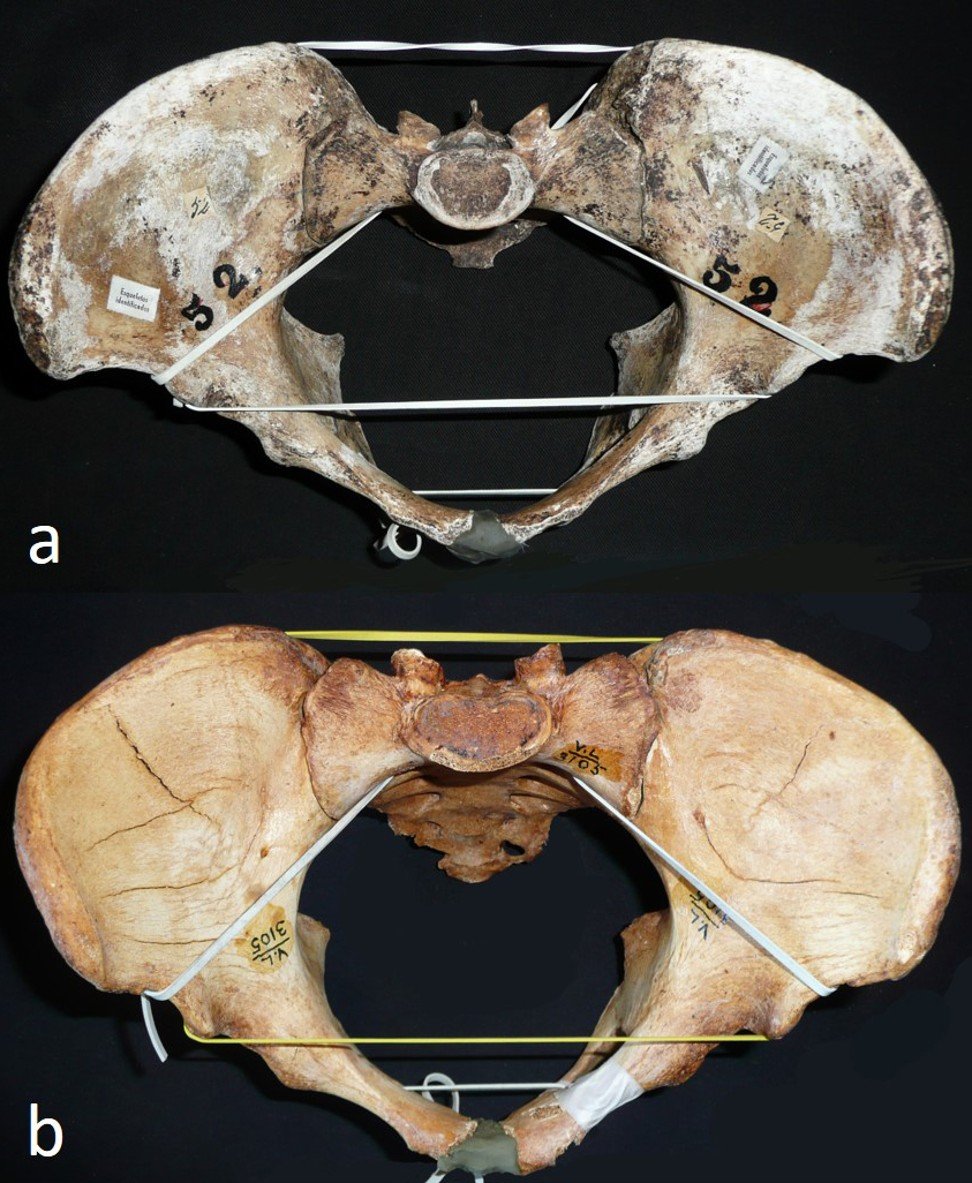 Two skeletal pelvises measured during the study showing a more oval and wider pelvic canal (a) found to be more common in Europe and the Americas, while birth canals that are more circular and deeper back-to-front (b) are found more frequently in Africa and Asia. Photo: AFP/University of Roehampton