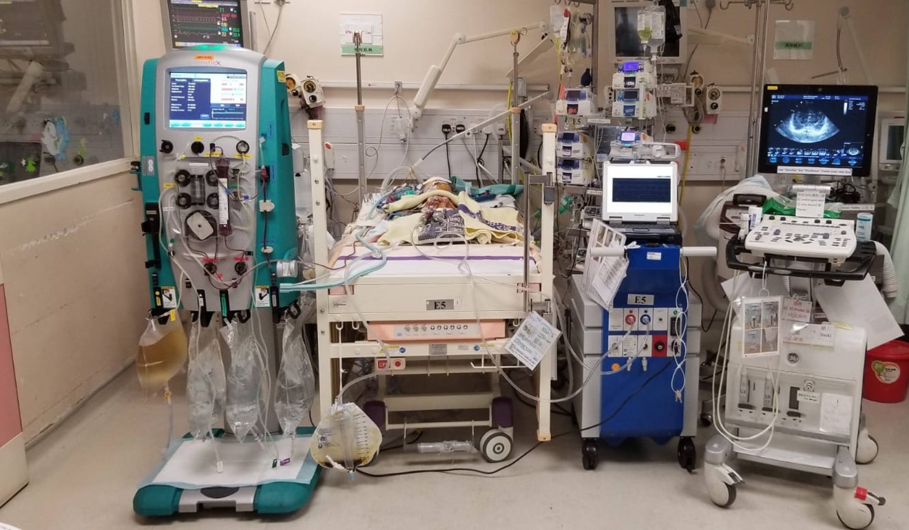Hui Chi-hoi is being kept alive with an artificial cardiac device and ventilator. Photo: Handout