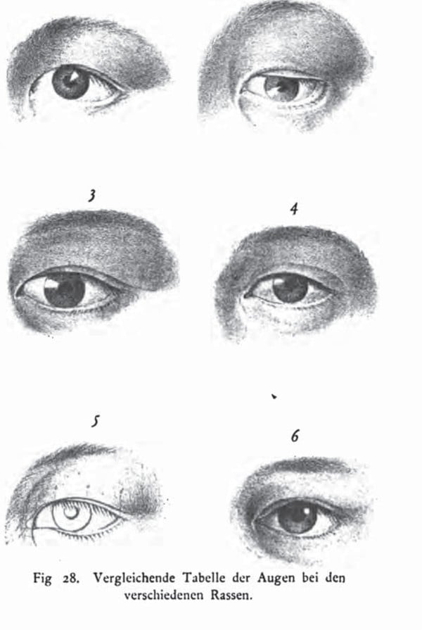 Nineteenth-century medical research frequently attempted to define the ‘yellow’ race as embodying physical conditions that distinguished them from Caucasians, including the ‘Mongolian eyefold’ (a fold of skin covering the canthus or inner corner of the eye). Photo: Handout