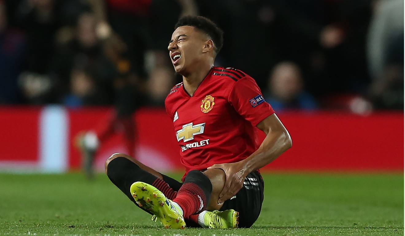 Jesse Lingard reacts after picking up an injury in the first half. Photo: EPA