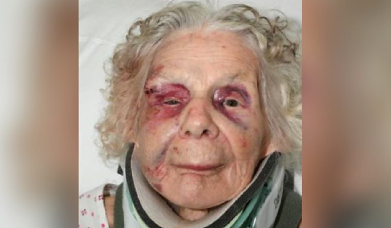 A police photo shows Sofija Kaczan in hospital after she was attacked Artur Waszkiewic. She later died. Photo: Derbyshire Constabulary