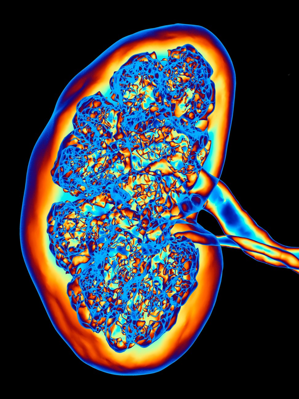 In a day your kidneys can filter 142 litres of blood and produce one litre of urine. Photo: Alamy