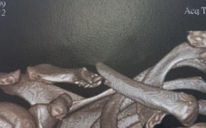 For the second time in two seasons, the Italian has returned is quick time from injuries suffered in shocking falls and has gone to any lengths to do so