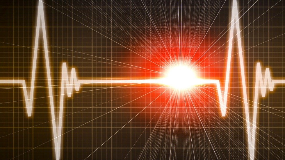 New defibrillator can be implanted without putting electrodes into heart South China Morning Post