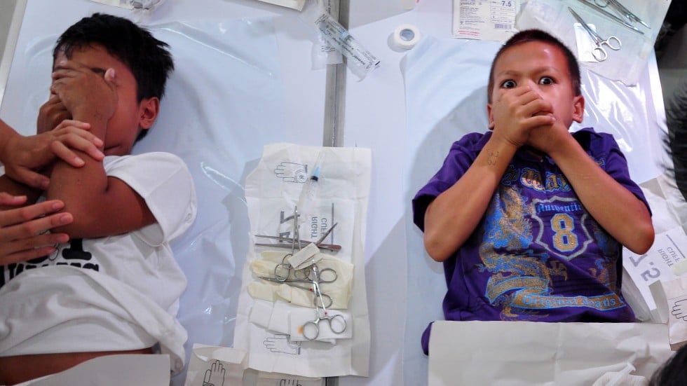 Chinese Device Cuts Surgery Time For Male Circumcisions To 5 Mins South China Morning Post 