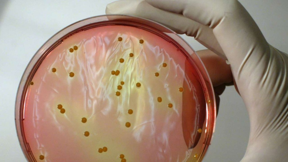 6 Things You Should Know About The Staphylococcus Bacteria A Potential   2c76dee6 228d 11e6 80b1 A87df553e801 1280x720.JPG